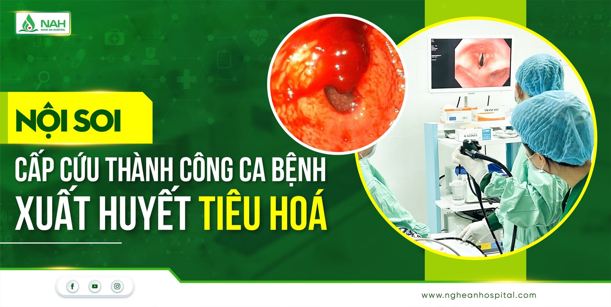 Đặt lịch qua App BV HNĐK NA2 giảm 50% phí khám